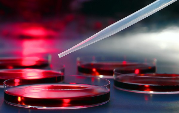 Interlaboratory Proficiency testing: Microbiological parameters in drinking water